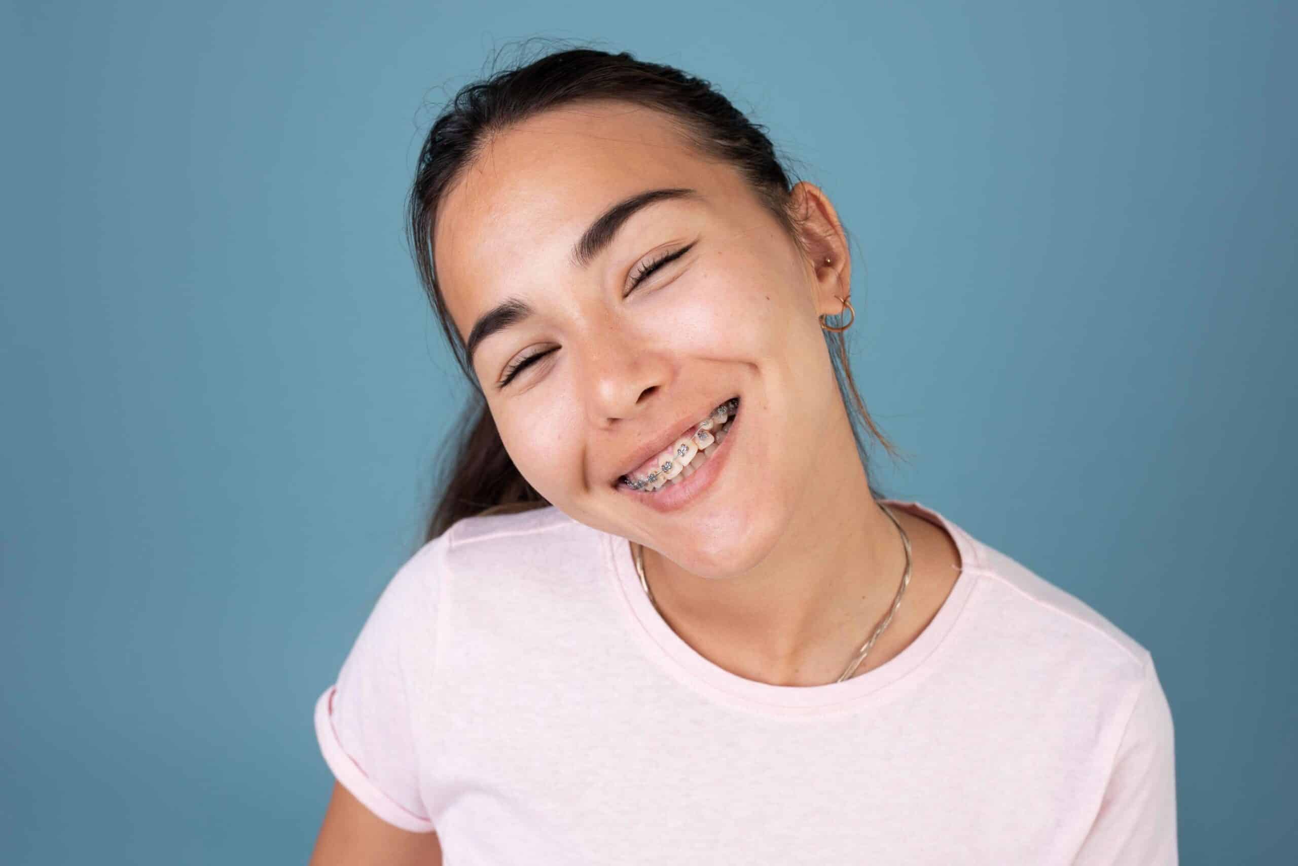 Types of Braces